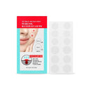 Plester Jerawat terbaik | AC Mild Red Spot Patch